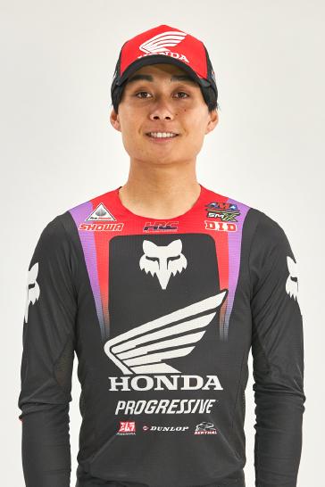 Jo Shimoda Undergoes Back Surgery